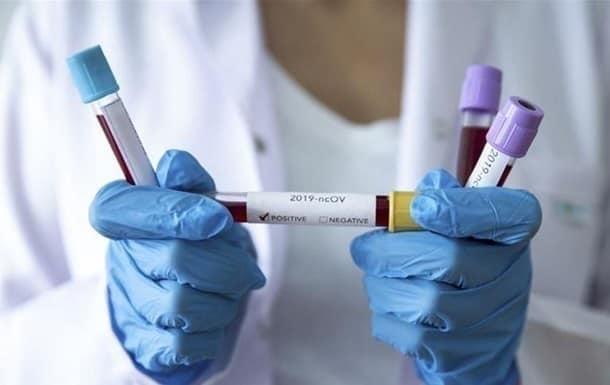 У Покрові ще два лабораторно підтверджені випадки коронавірусу